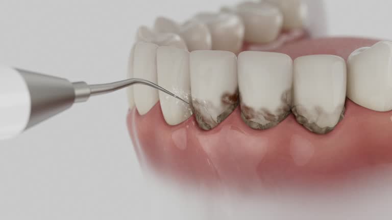 Trusted Teeth Cleaning And Checkup service in New Rockford, ND - Dentist Open Now